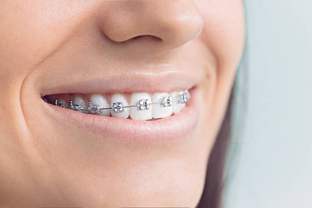 Best Teeth Whitening  in Palos Verdes Estates, CA